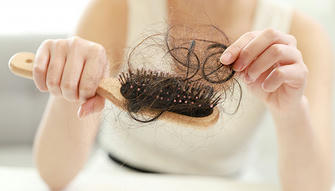 Causes and Treatment of Hair Loss